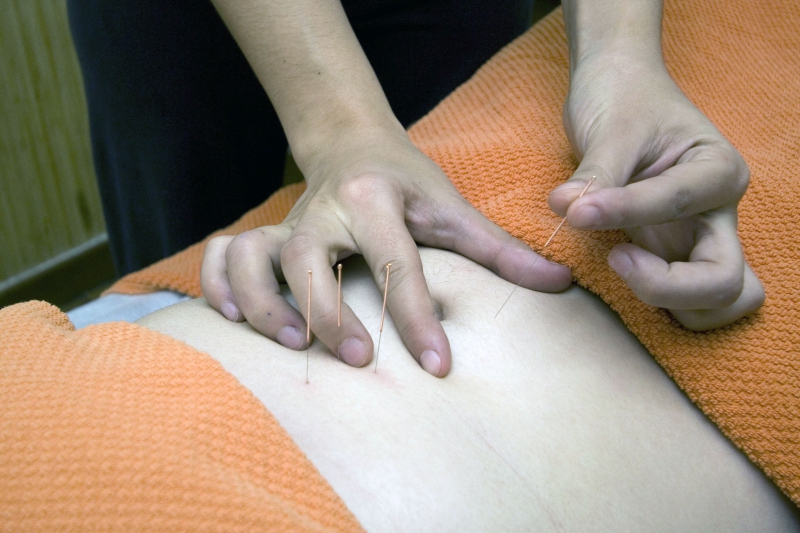 osteopathe-PEILLON-min_acupuncture-4175625